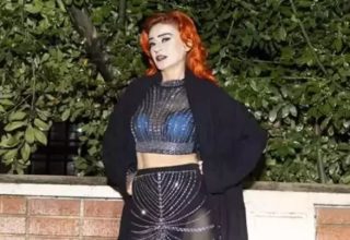 Yıldız Tilbe’nin Yüzüne Ne Oldu? Son Paylaşımı Sevenlerini Korkuttu!